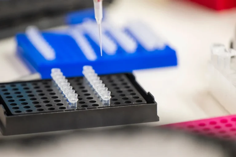(A lab technician prepares DNA samples for analysis in San Jose, Calif., July 22, 2024. (AP File Photo: Nic Coury)